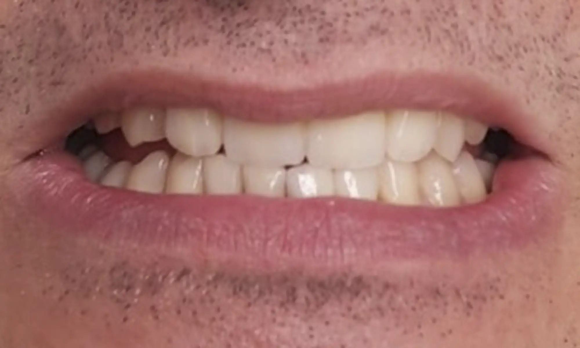 1987654321Без имени-1