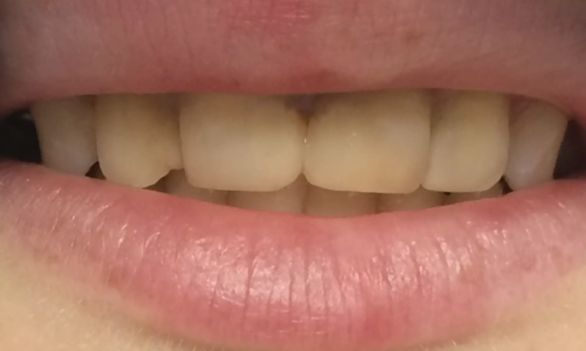 4543211Без имени-1